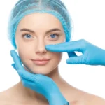 Young woman ready for rhinoplasty